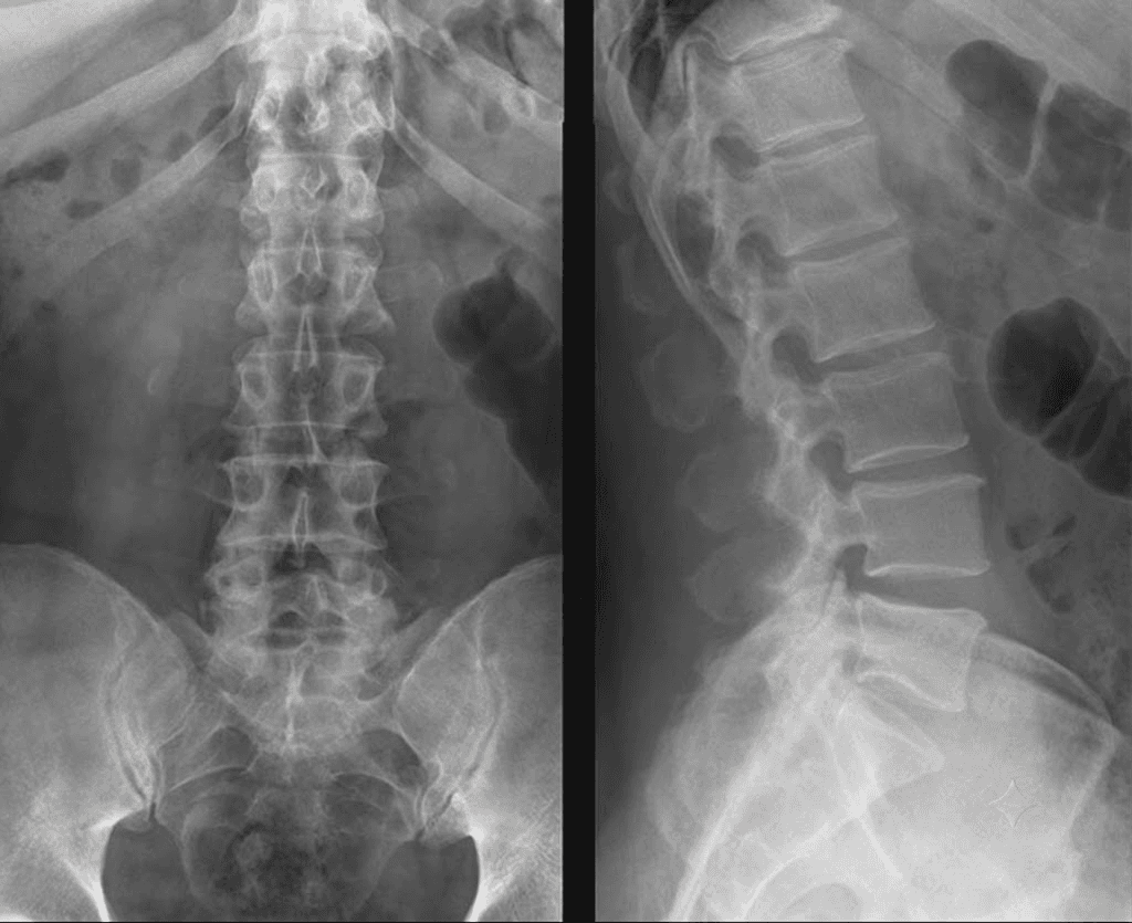 Spine Imaging